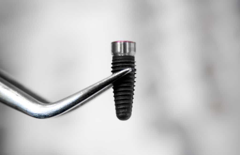 Implant