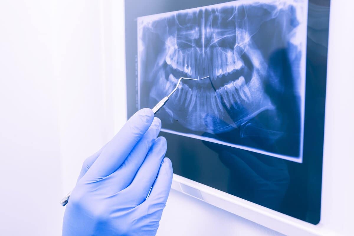 Digital Dental X ray Copy