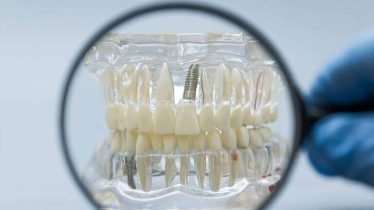 boli implantat