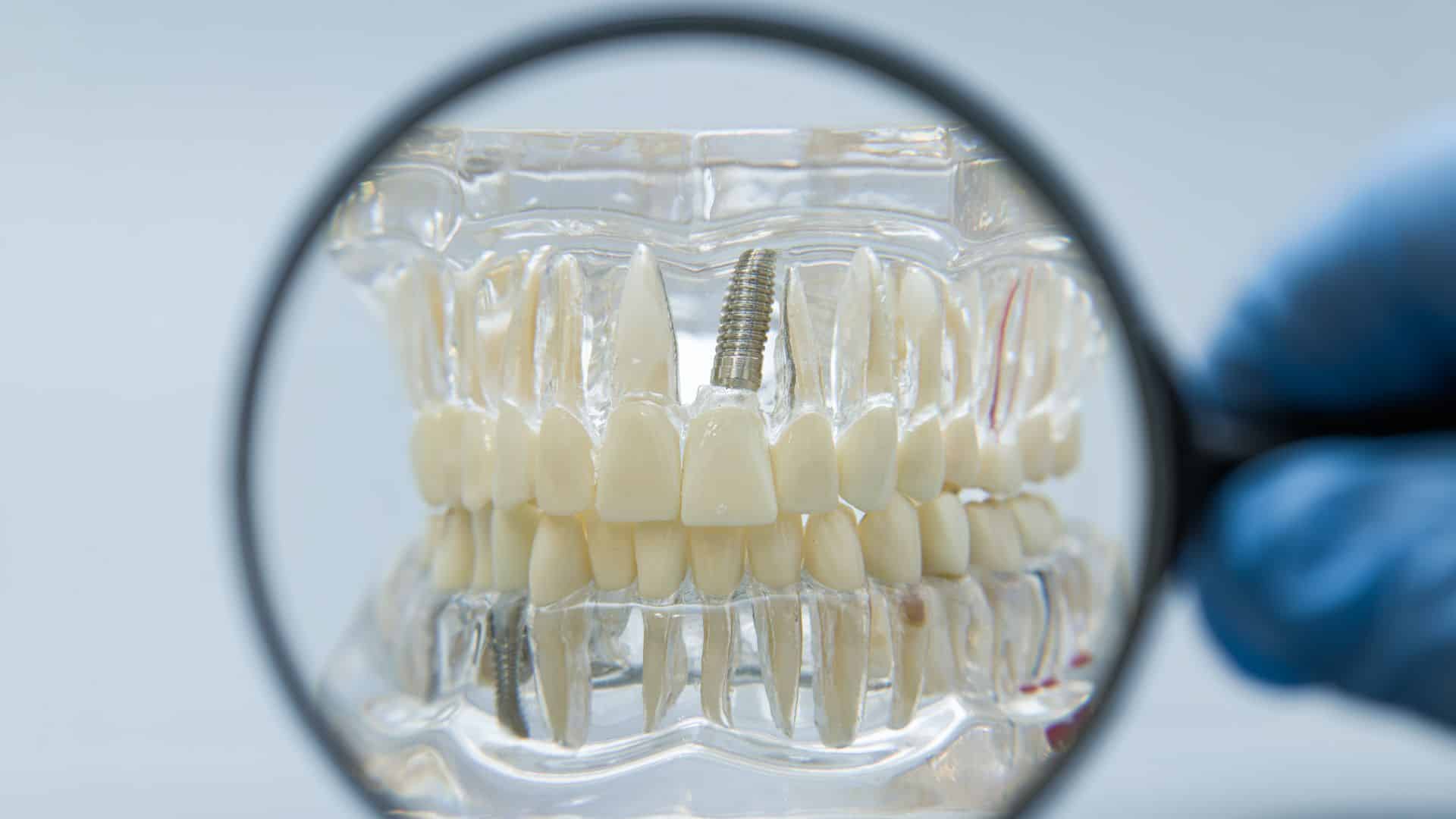 boli implantat